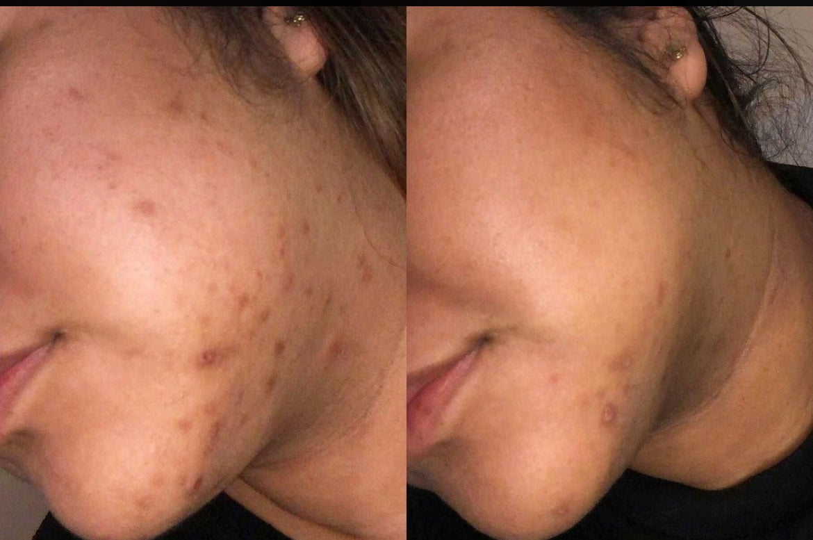Good Molecules Suero Facial Discoloration Correcting Serum