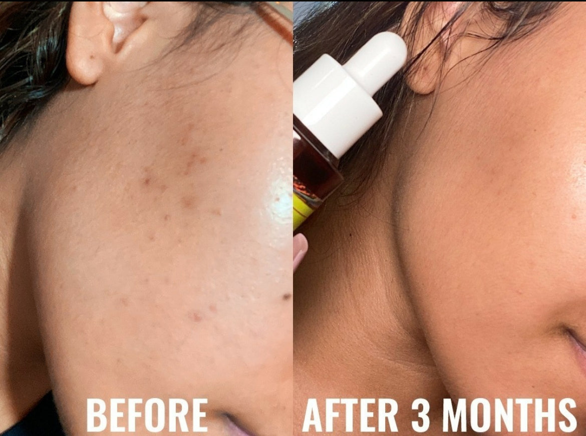 Good Molecules Suero Facial Discoloration Correcting Serum