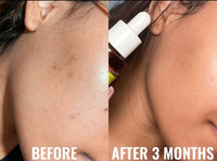 Good Molecules Suero Facial Discoloration Correcting Serum