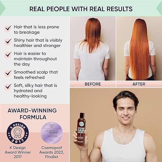 Crecimiento del cabello definitivo de Moérie