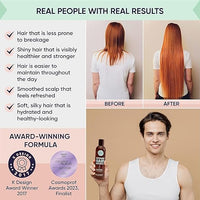 Crecimiento del cabello definitivo de Moérie