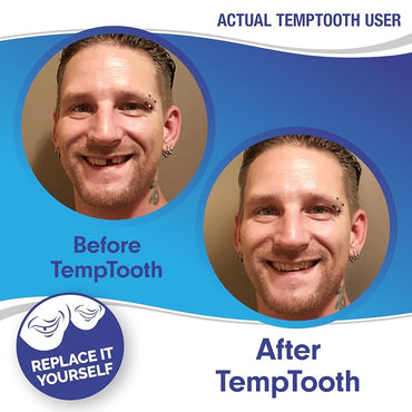 Kit de reemplazo de dientes temporales (kit individual) - La Tiendita de la Jose