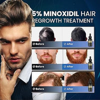 Suero para el crecimiento del cabello de minoxidil al 5%