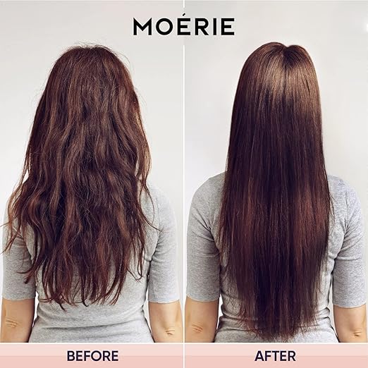 Crecimiento del cabello definitivo de Moérie