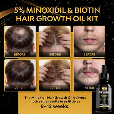 Suero para el crecimiento del cabello Profolix - La Tiendita de la Jose