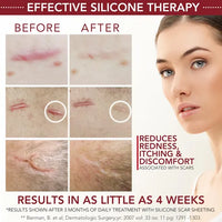 Láminas semisólidas de gel de silicona para cicatrices Healfast Physician