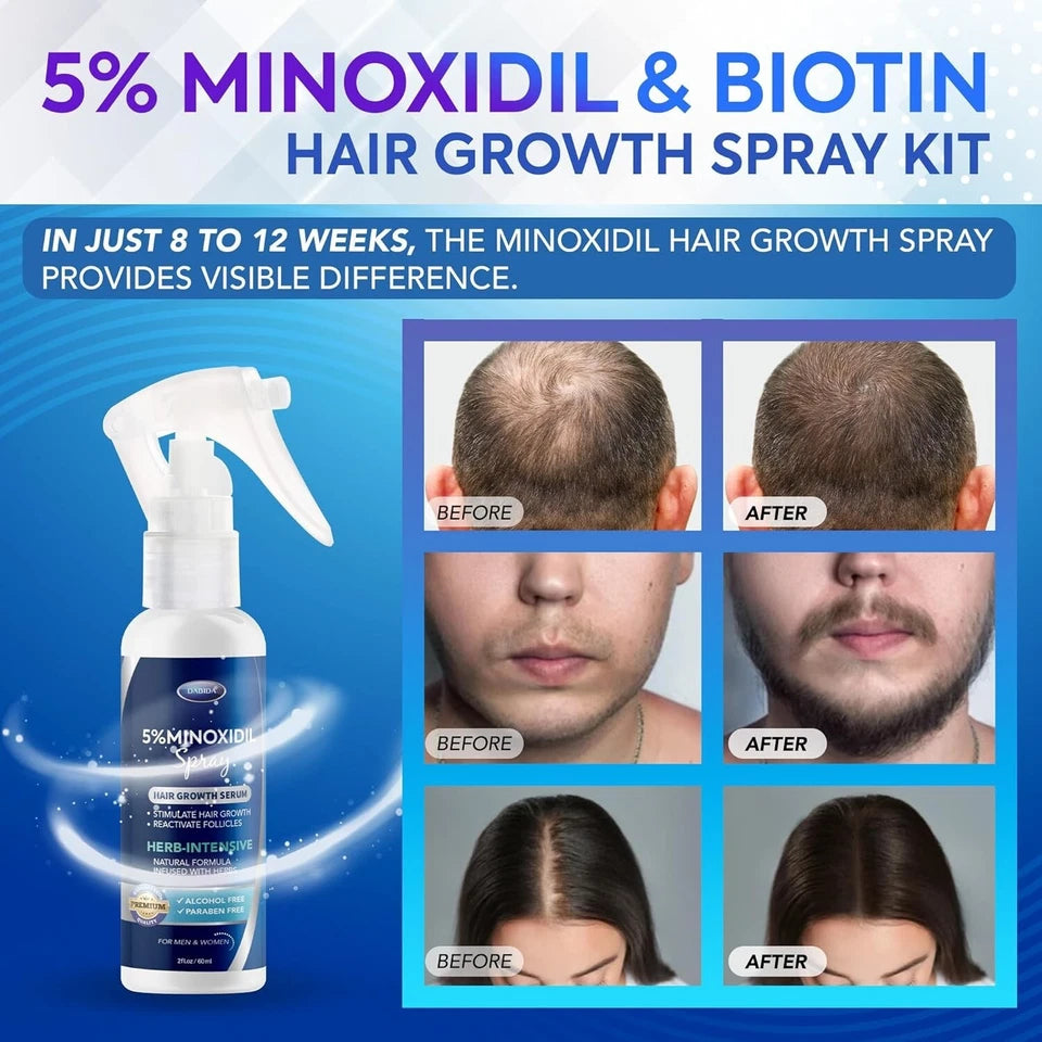 5% minoxidil para hombres y mujeres suero para crecimiento del cabello.