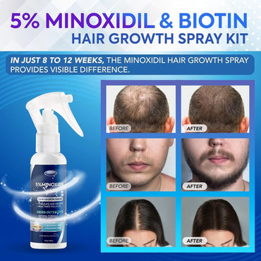 5% minoxidil para hombres y mujeres suero para crecimiento del cabello.