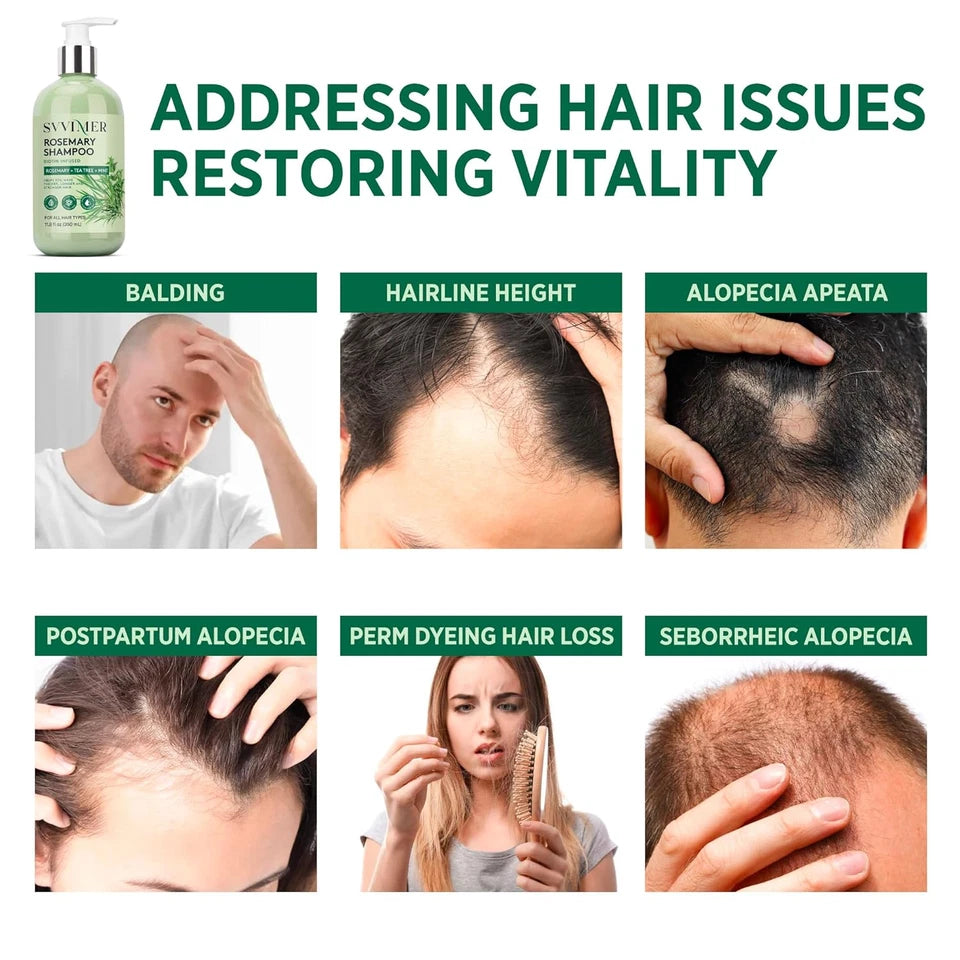 shampoo para el crecimiento del cabello de romero con biotina y aceite de árbol de té - La Tiendita de la Jose